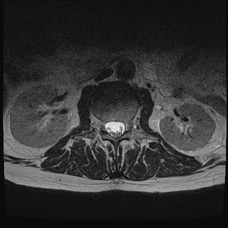 92c0bb30-c11b-49d3-a42a-19c58978aefd