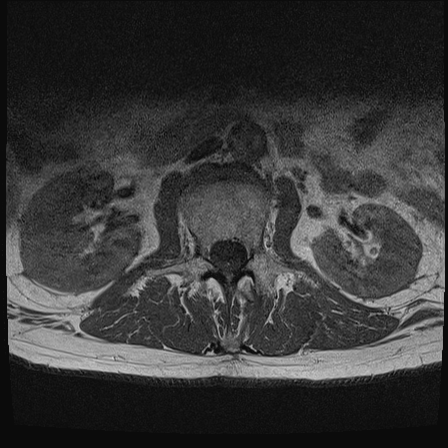 23329e07-3336-423a-bba5-c5641e9d383a